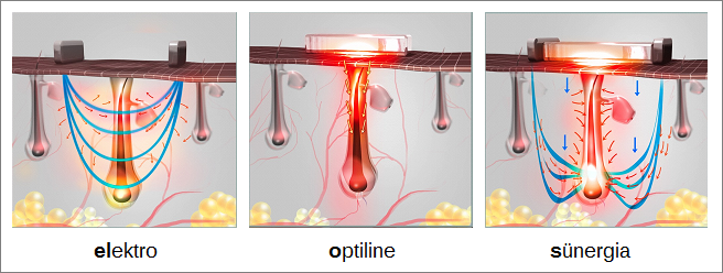 elektro optiline sünergia